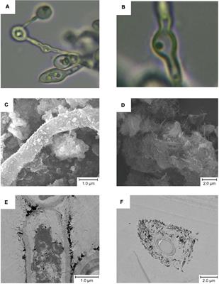 Physiological, Genomic and Transcriptomic Analyses Reveal the Adaptation Mechanisms of Acidiella bohemica to Extreme Acid Mine Drainage Environments